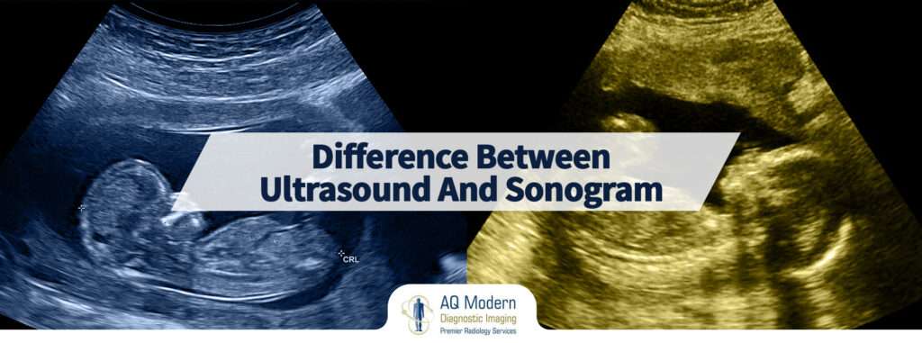 ultrasound nj