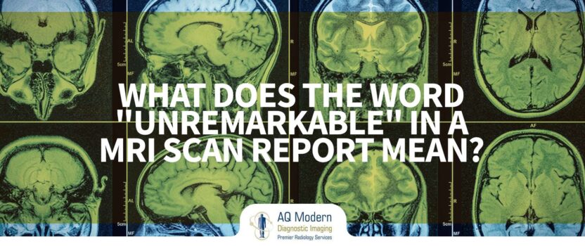 mri-elizabeth-nj-whats-the-word-unremarkable-mean-in-mri-report