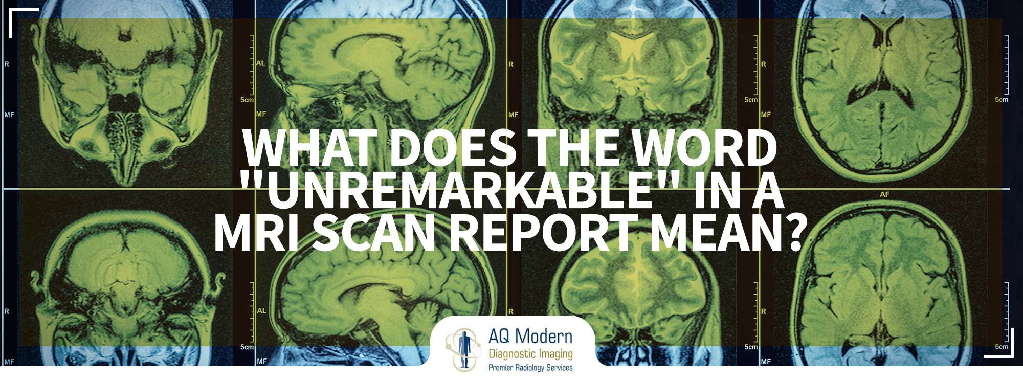 MRI Elizabeth NJ - Whats the word 'unremarkable' Mean in MRI ...