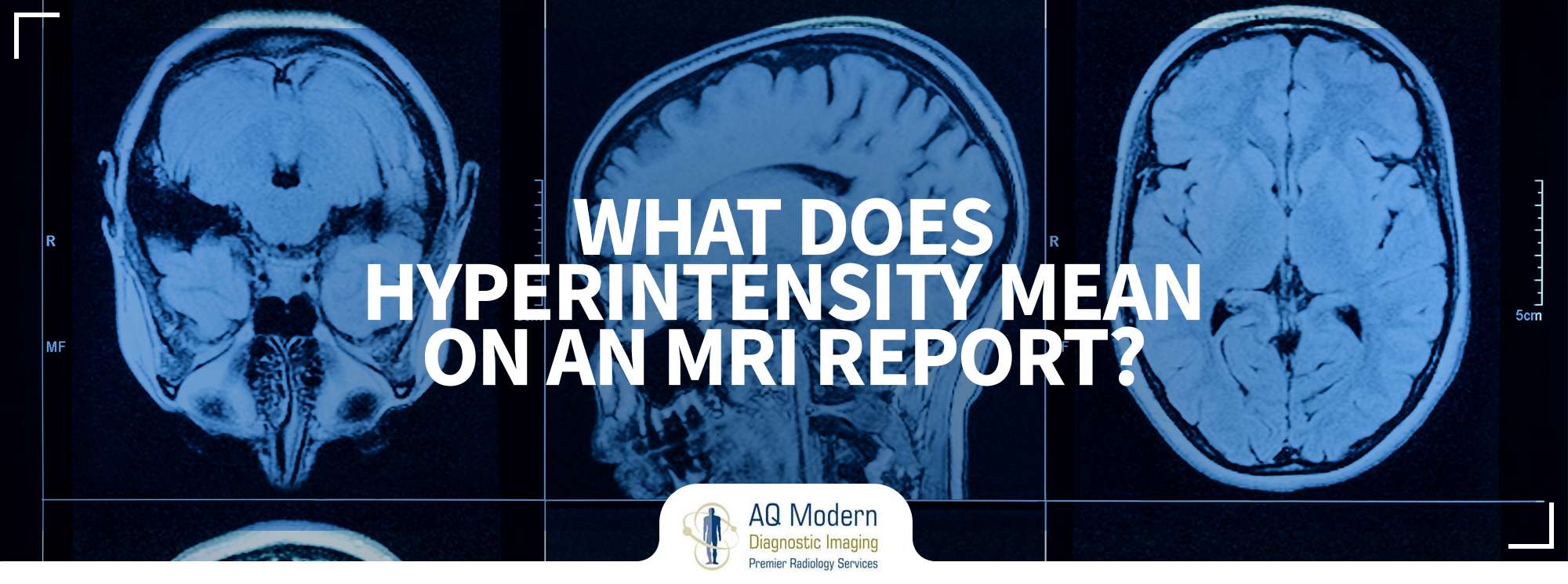 mri-hyperintensity