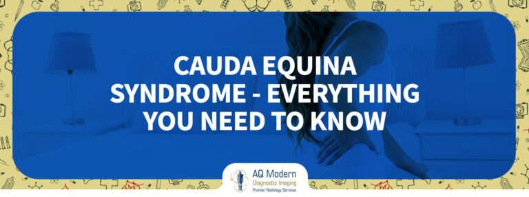 Cauda Equina Syndrome – All you need to Know