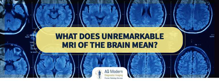 What Does Unremarkable MRI Of The Brain Mean 