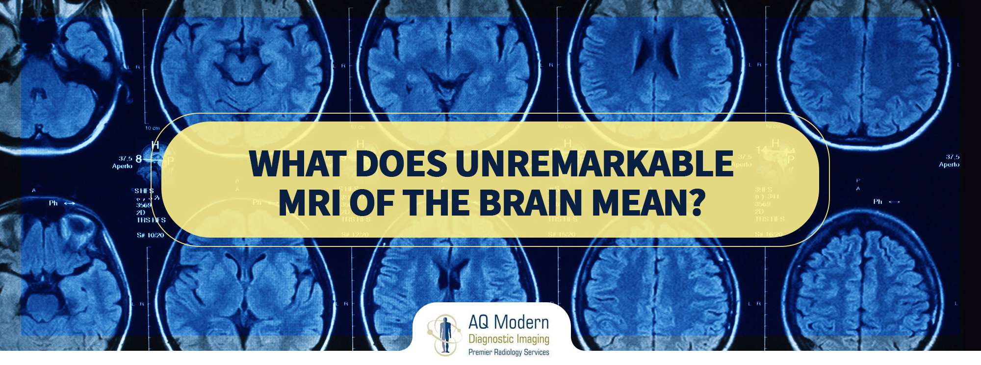 Brain MRI: What It Is, Purpose, Procedure & Results
