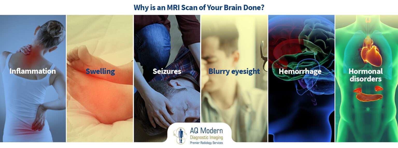 what-does-unremarkable-mri-of-the-brain-mean