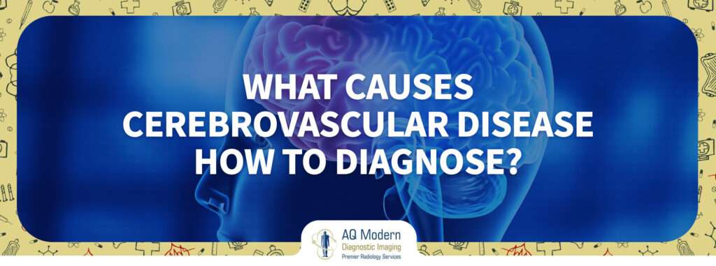 cerebrovascular-diseases