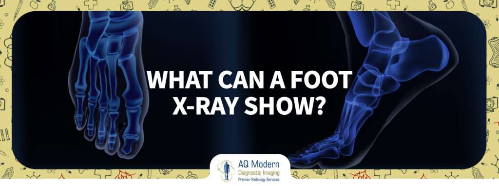foot-x-ray