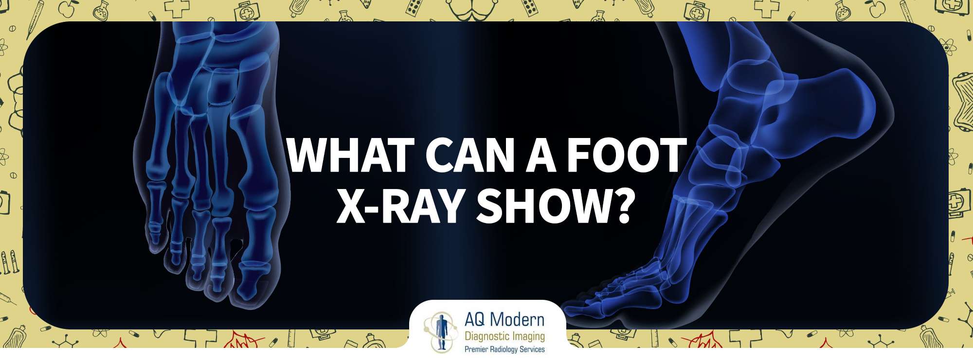 xray of foot