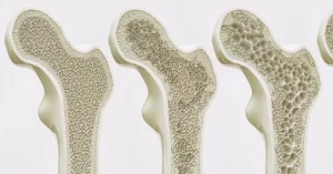 all-you-need-to-know-about-bone-density