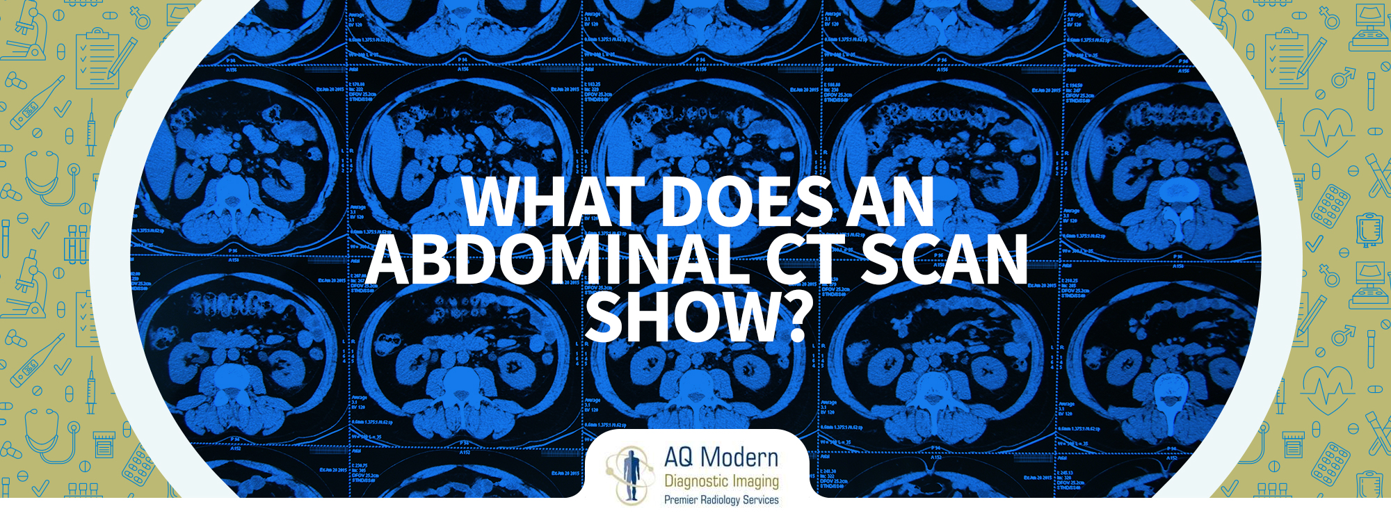 abdominal-ct-scan