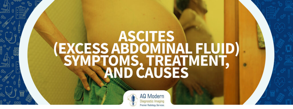 diagnosis-of-ascites