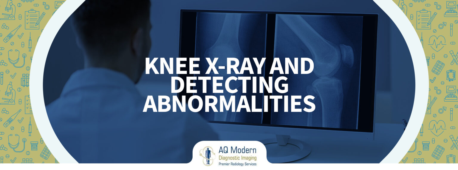 Knee X-Ray and Detecting Abnormalities