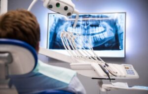 Purpose of a Dental X-ray