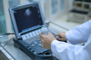 breast ultrasound