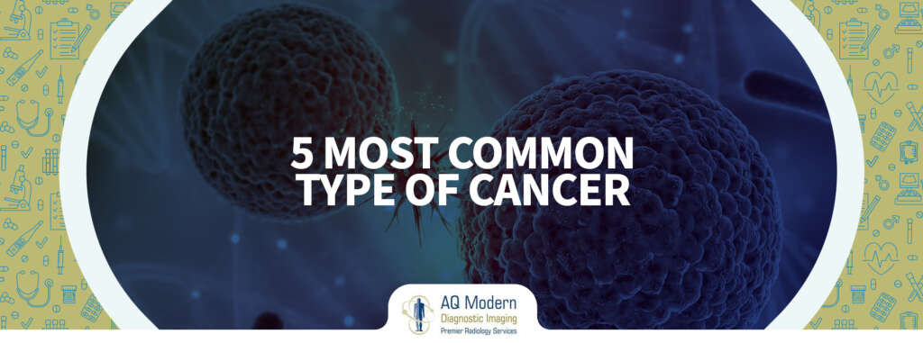 What Are the 5 Most Common Type of Cancer - AQMDI Blogs