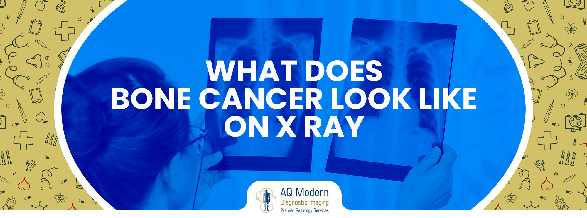 what does a bone cancer look like on a x ray