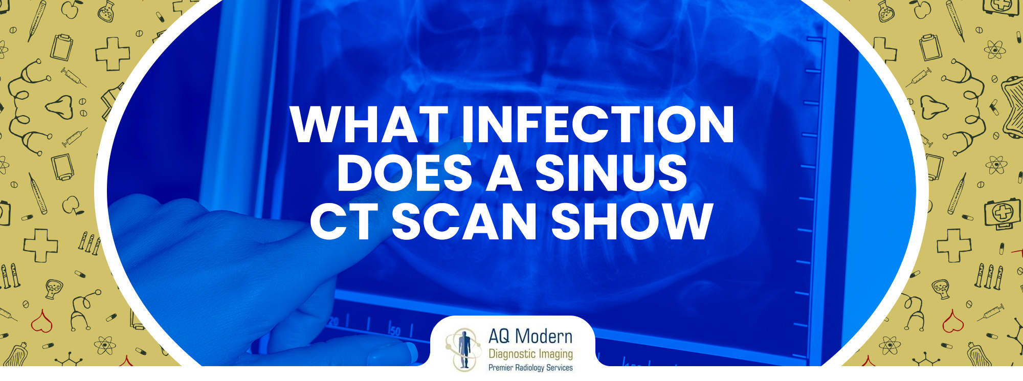 sinus ct scan