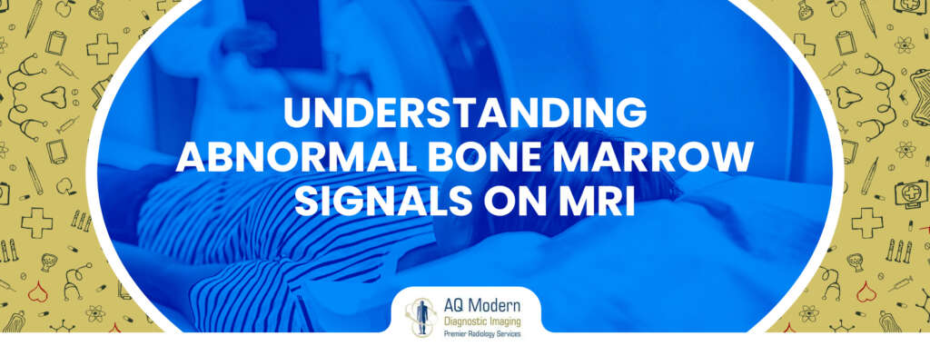 abnormal bone marrow signals