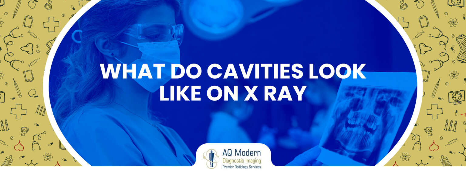 DO PANORAMIC X RAYS SHOW CAVITIES visual data 3
