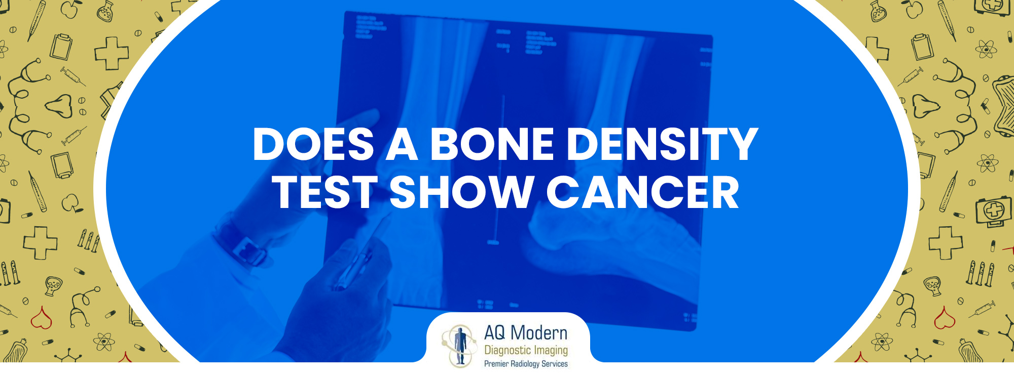 bone density tests show cancer