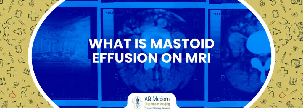 What is Mastoid Effusion on MRI - AQ Imaging Network