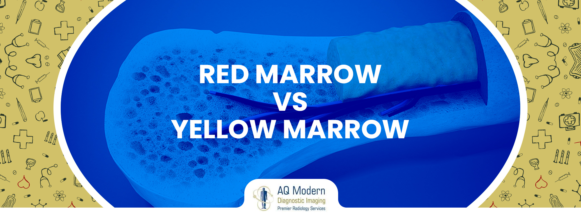 Red Marrow vs. Yellow Marrow