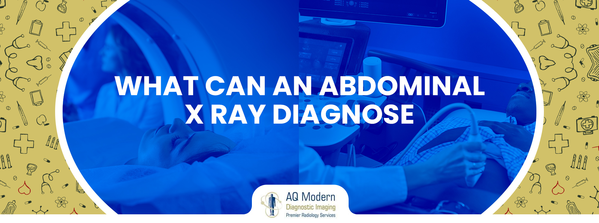 What-Can-An-Abdominal-X-Ray-Diagnose