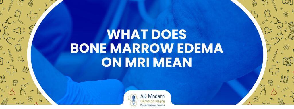 what-does-bone-marrow-edema-on-mri-mean-aq-imaging-network