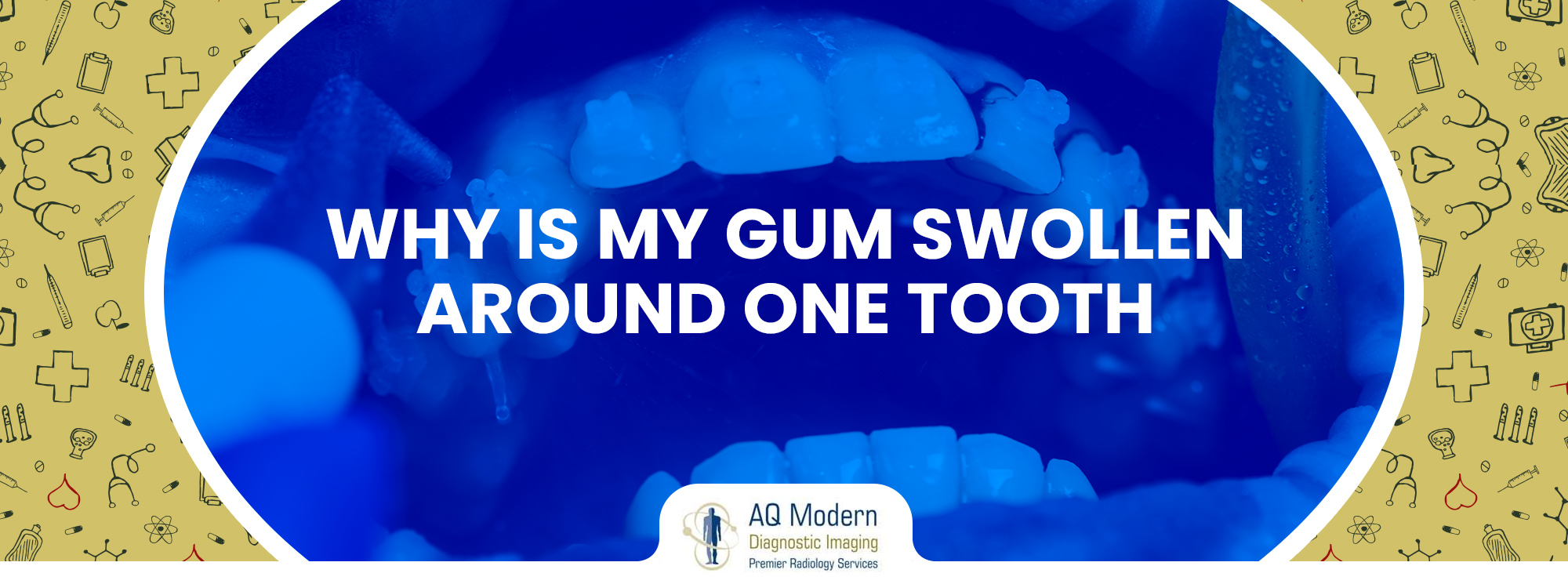 gum swollen around one tooth