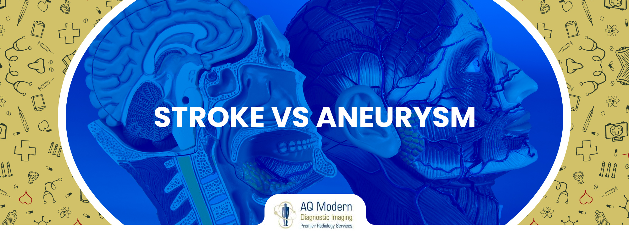 Stroke and aneurysm